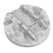 Load image into Gallery viewer, 80mm Round Trench Base Set #C